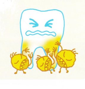 歯と虫歯イメージ