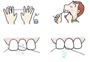 正しい歯ブラシの選び方　プロがやっている５つの歯磨きポイント！