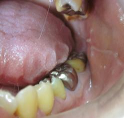 舌をみたら病気がわかる　４つの診断