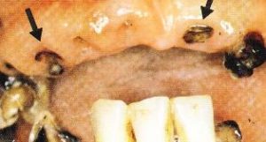 抜歯確定の症例