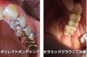歯科と関連が深い埼玉の金属アレルギー専門医