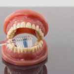 歯周病の罹患率には地域差があるの？？
